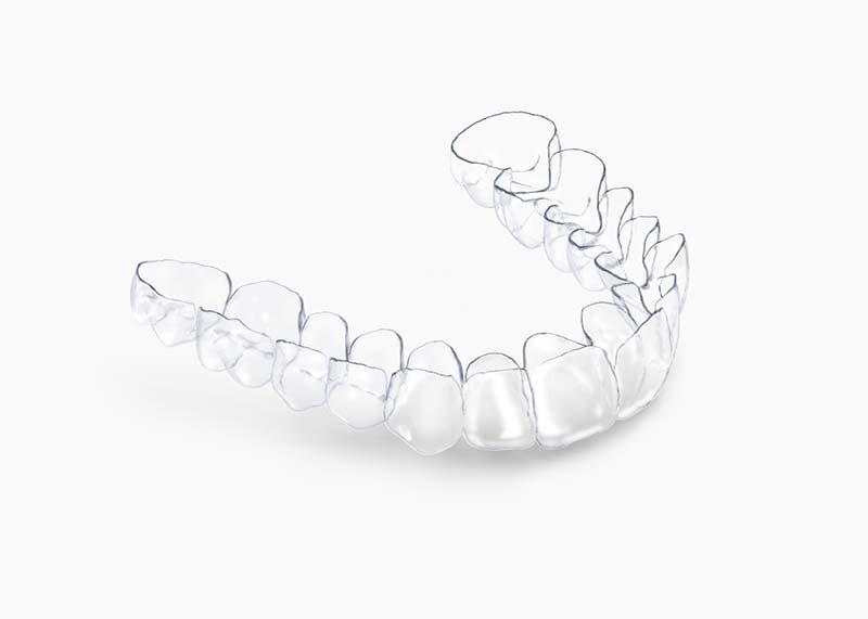 Aligners